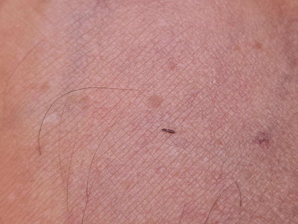 Piccoli insetti neri